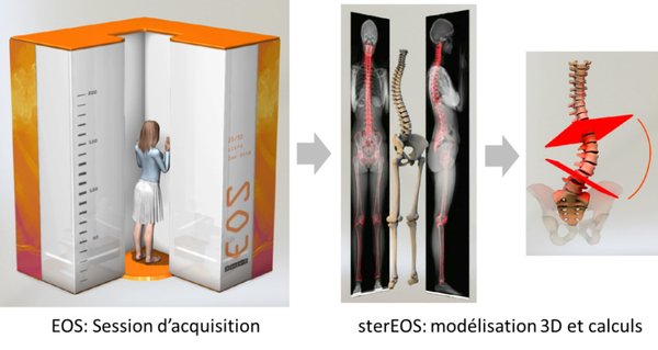eos systeme revolutionnaire radiographie processus